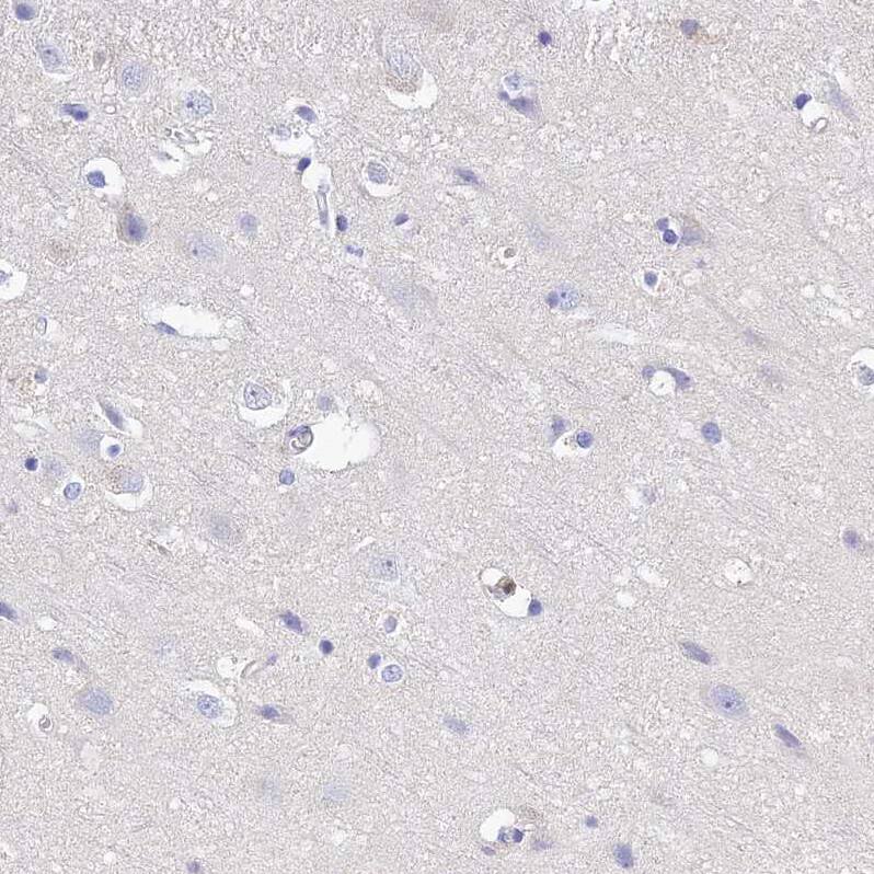 MS4A5 Antibody - BSA Free Immunohistochemistry: MS4A5 Antibody - BSA Free [NBP1-92143]