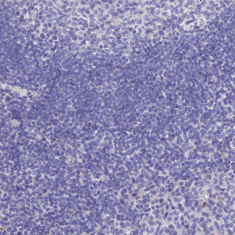 MS4A5 Antibody - BSA Free Immunohistochemistry: MS4A5 Antibody - BSA Free [NBP1-92143]