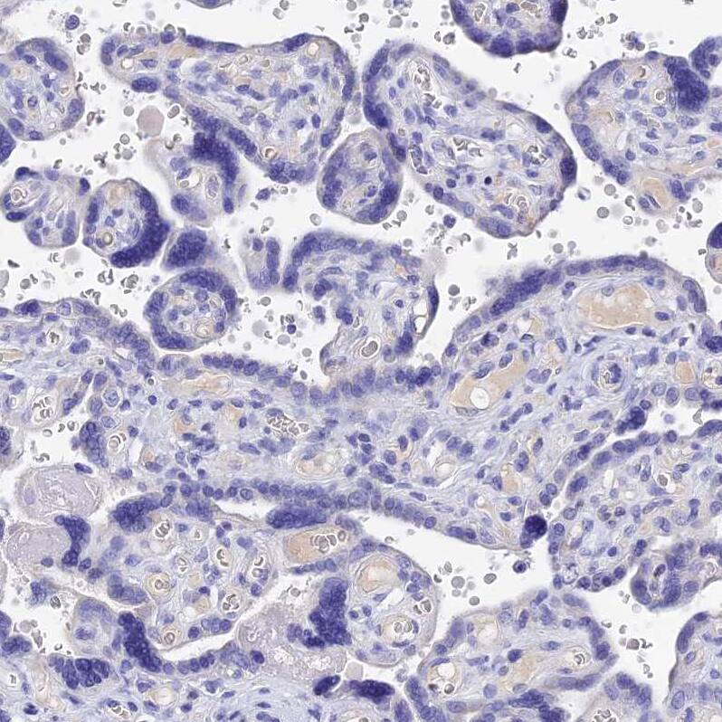 MS4A5 Antibody - BSA Free Immunohistochemistry: MS4A5 Antibody - BSA Free [NBP1-92143]