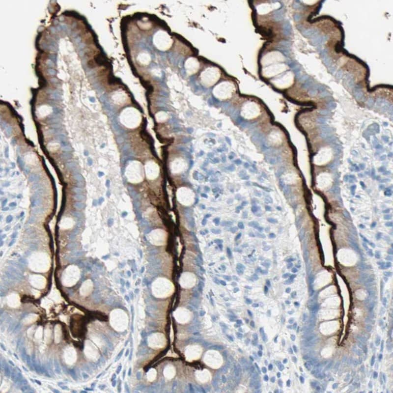 MUCDHL Antibody - BSA Free Immunohistochemistry: MUCDHL Antibody - BSA Free [NBP1-92148]