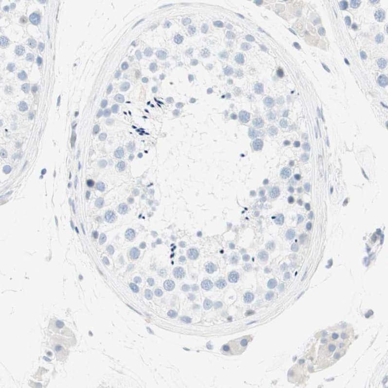 MUCDHL Antibody - BSA Free Immunohistochemistry-Paraffin: MUCDHL Antibody [NBP1-92149]