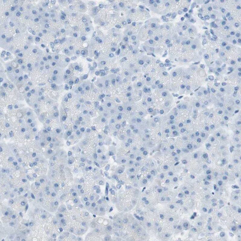 MUCDHL Antibody - BSA Free Immunohistochemistry: MUCDHL Antibody - BSA Free [NBP1-92149]