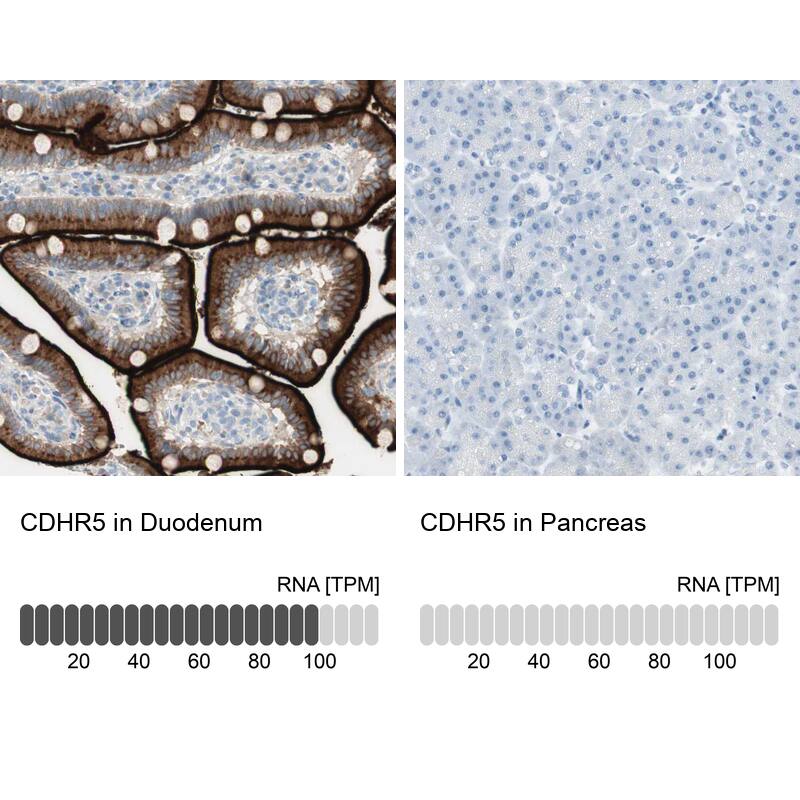 MUCDHL Antibody - BSA Free Immunohistochemistry: MUCDHL Antibody - BSA Free [NBP1-92149]