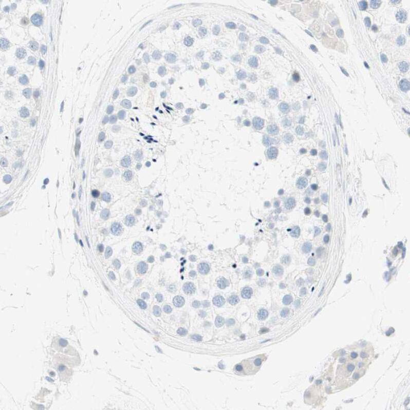 MUCDHL Antibody - BSA Free Immunohistochemistry: MUCDHL Antibody - BSA Free [NBP1-92149]