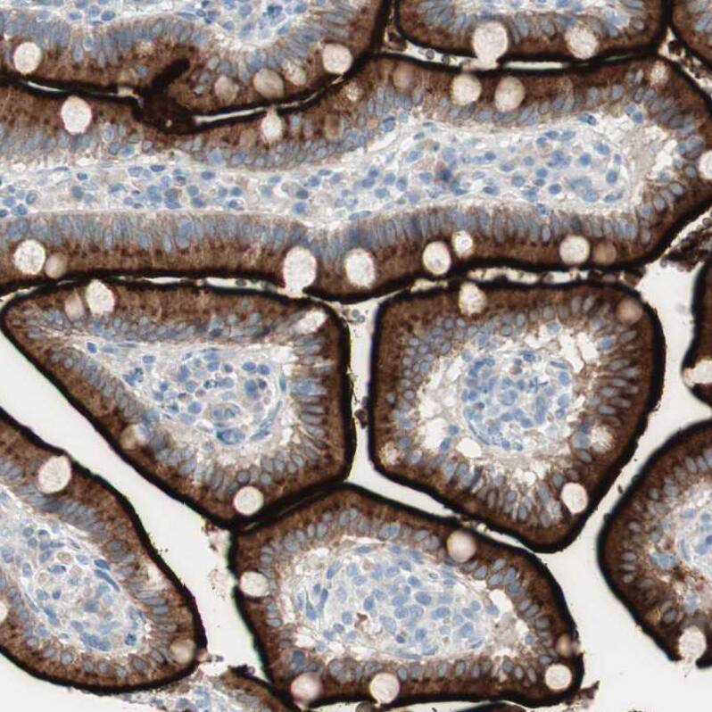 MUCDHL Antibody - BSA Free Immunohistochemistry: MUCDHL Antibody - BSA Free [NBP1-92149]