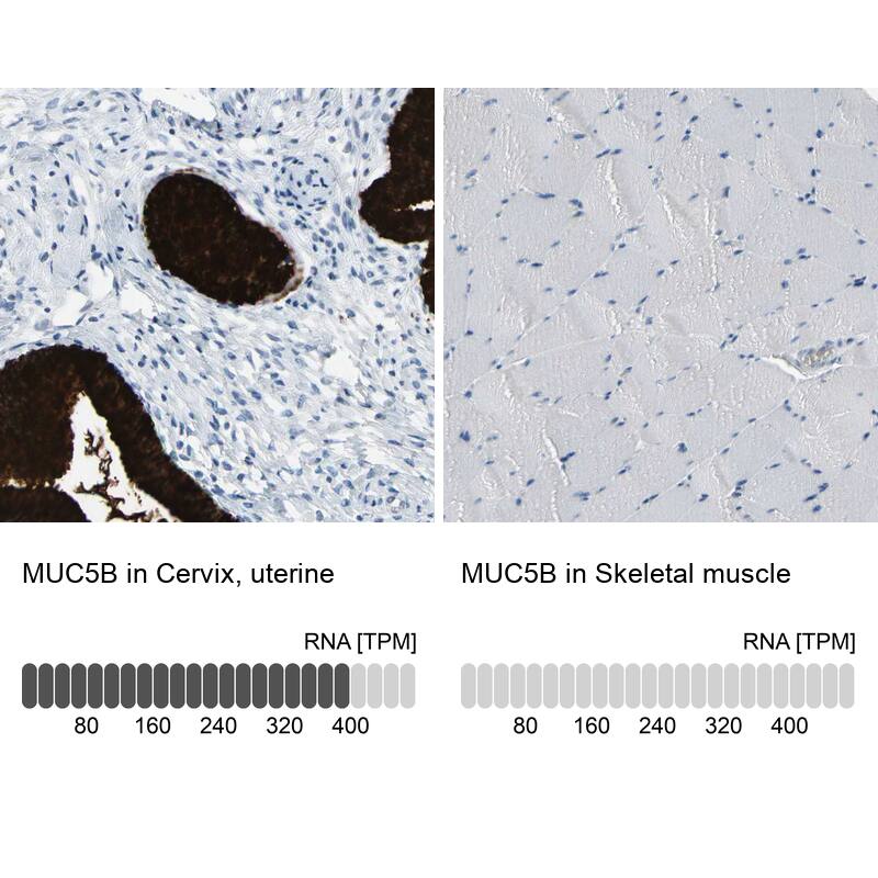 MUC5B Antibody - BSA Free Immunohistochemistry: MUC5B Antibody - BSA Free [NBP1-92151]