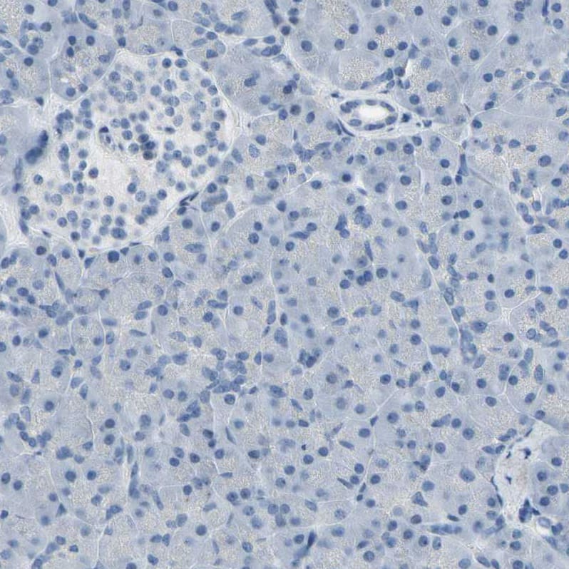 MUC5B Antibody - BSA Free Immunohistochemistry: MUC5B Antibody - BSA Free [NBP1-92151]