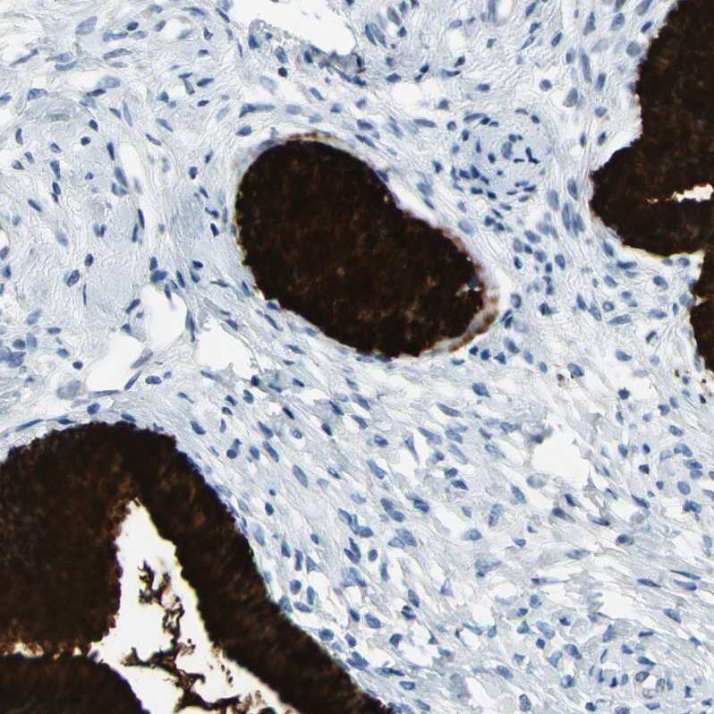 MUC5B Antibody - BSA Free Immunohistochemistry: MUC5B Antibody - BSA Free [NBP1-92151]