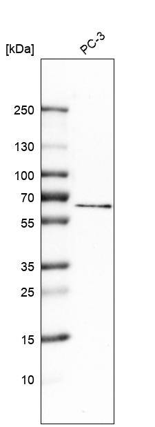 Mucolipin 1 Antibody - BSA Free Western Blot: Mucolipin 1 Antibody - BSA Free [NBP1-92152]
