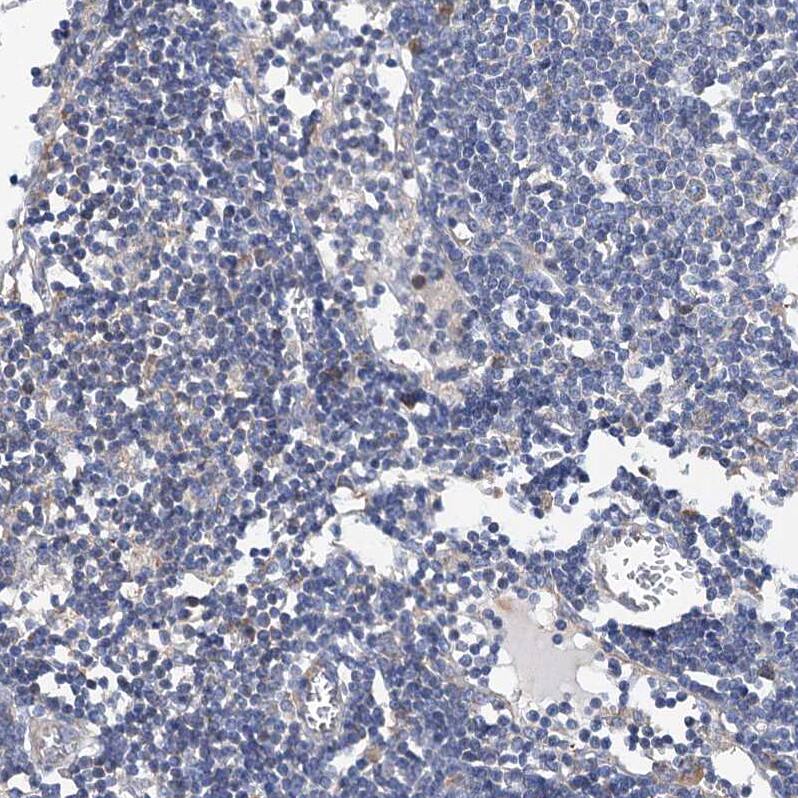 MURF2 Antibody - BSA Free Immunohistochemistry: MURF2 Antibody - BSA Free [NBP1-92153]