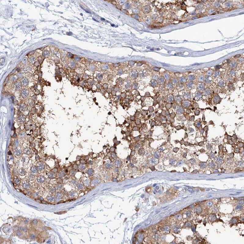 MURF2 Antibody - BSA Free Immunohistochemistry: MURF2 Antibody - BSA Free [NBP1-92153]