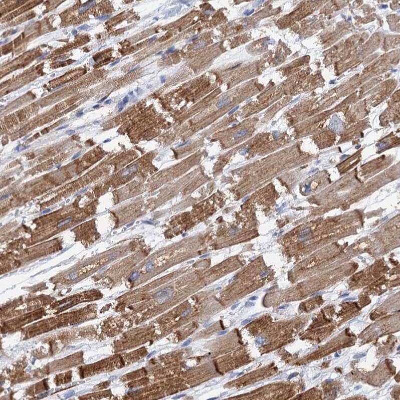 MURF2 Antibody - BSA Free Immunohistochemistry: MURF2 Antibody - BSA Free [NBP1-92153]
