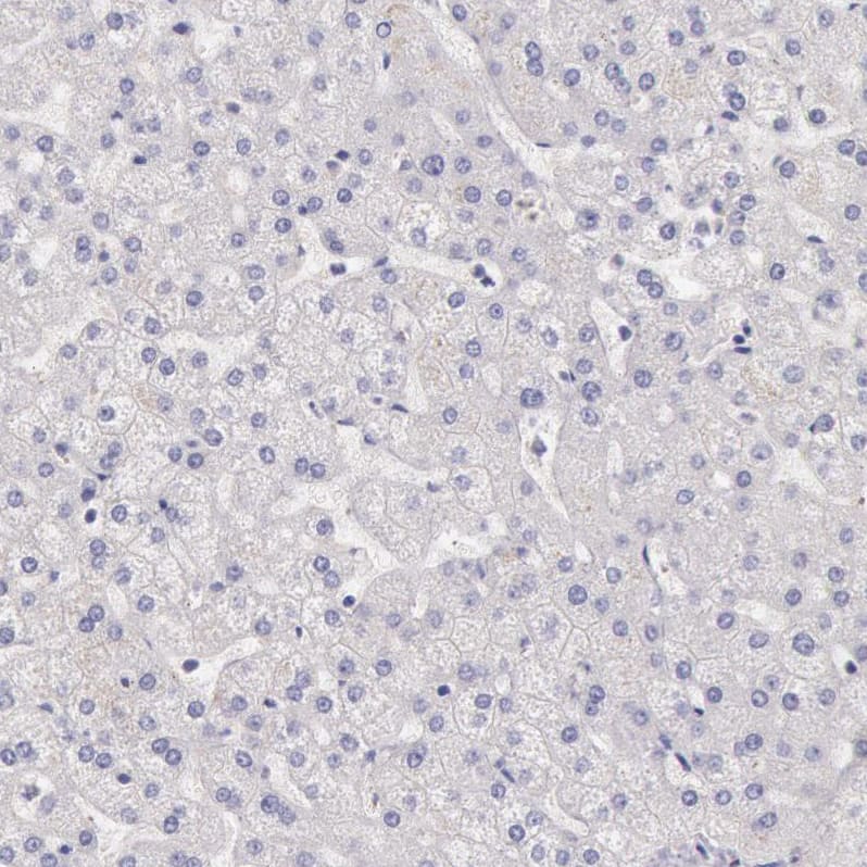 Myosin 5a Antibody - BSA Free Immunohistochemistry: Myosin 5a Antibody - BSA Free [NBP1-92156]