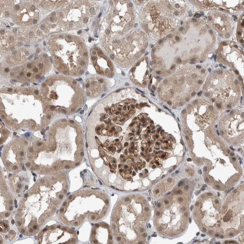Myosin 1E Antibody - BSA Free Immunohistochemistry: Myosin 1E Antibody - BSA Free [NBP1-92158]