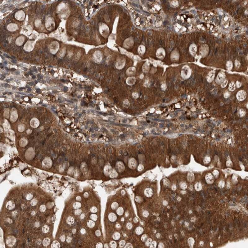 Myosin 1E Antibody - BSA Free Immunohistochemistry: Myosin 1E Antibody - BSA Free [NBP1-92158]