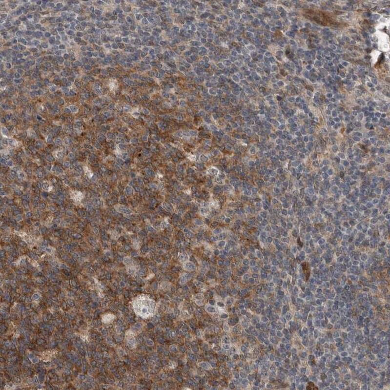 Myosin 1E Antibody - BSA Free Immunohistochemistry: Myosin 1E Antibody - BSA Free [NBP1-92158]