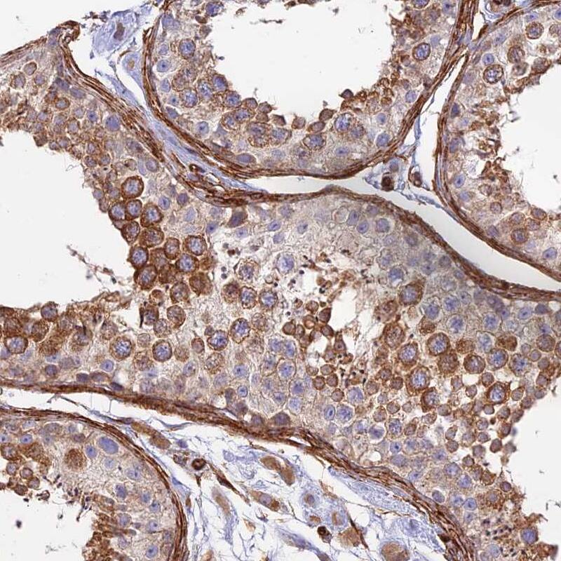 Myosin IXA Antibody - BSA Free Immunohistochemistry: Myosin IXA Antibody - BSA Free [NBP1-92160]
