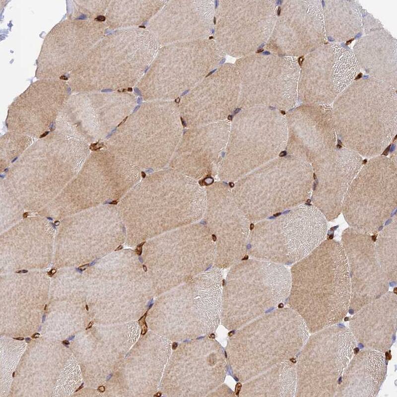 Myosin IXA Antibody - BSA Free Immunohistochemistry: Myosin IXA Antibody - BSA Free [NBP1-92160]