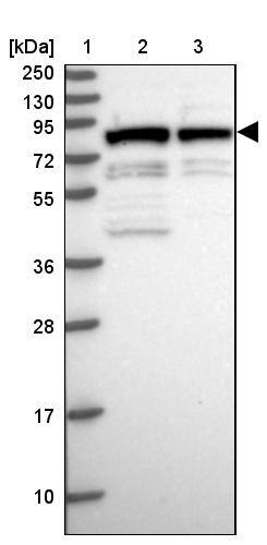 HBO1 Antibody - BSA Free Western Blot: HBO1 Antibody - BSA Free [NBP1-92161]