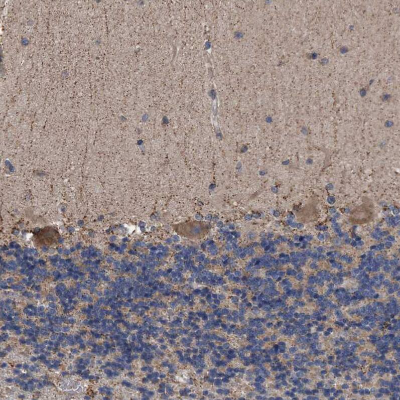 NARG1 Antibody - BSA Free Immunohistochemistry: NARG1 Antibody - BSA Free [NBP1-92165]