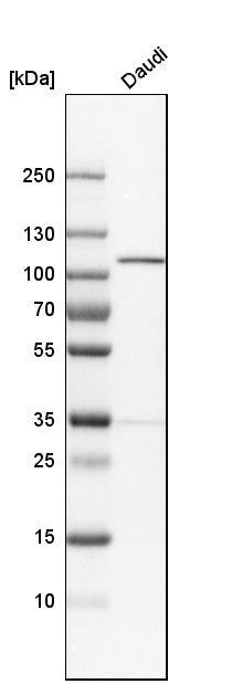 NARG1 Antibody - BSA Free Western Blot: NARG1 Antibody - BSA Free [NBP1-92165]
