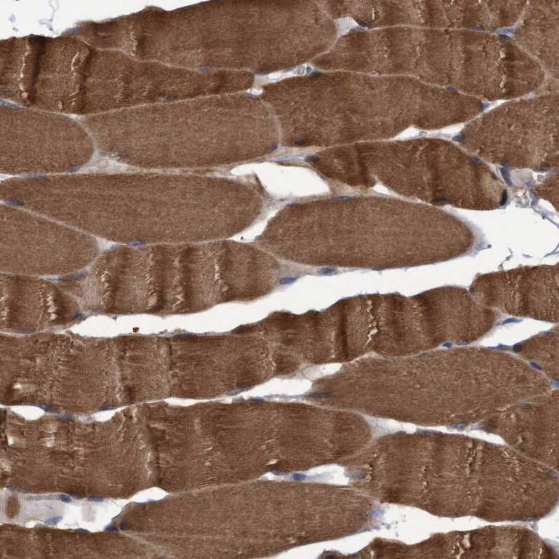 NARG1 Antibody - BSA Free Immunohistochemistry: NARG1 Antibody - BSA Free [NBP1-92165]