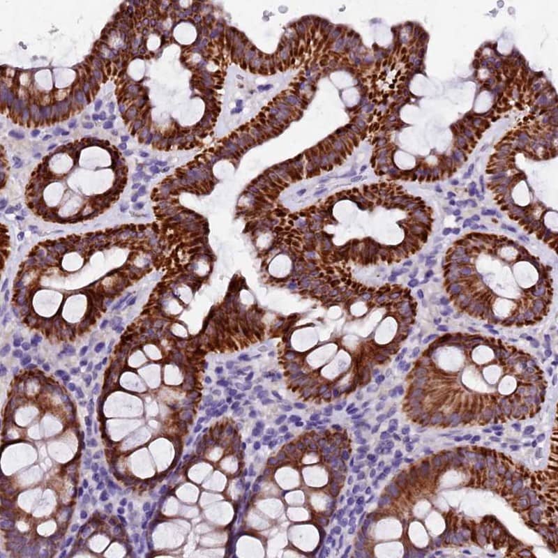 NARG1L Antibody - BSA Free Immunohistochemistry-Paraffin: NARG1L Antibody [NBP1-92166]