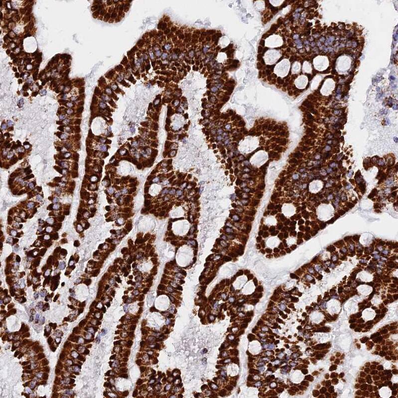 NDUFB6 Antibody - BSA Free Immunohistochemistry: NDUFB6 Antibody - BSA Free [NBP1-92172]