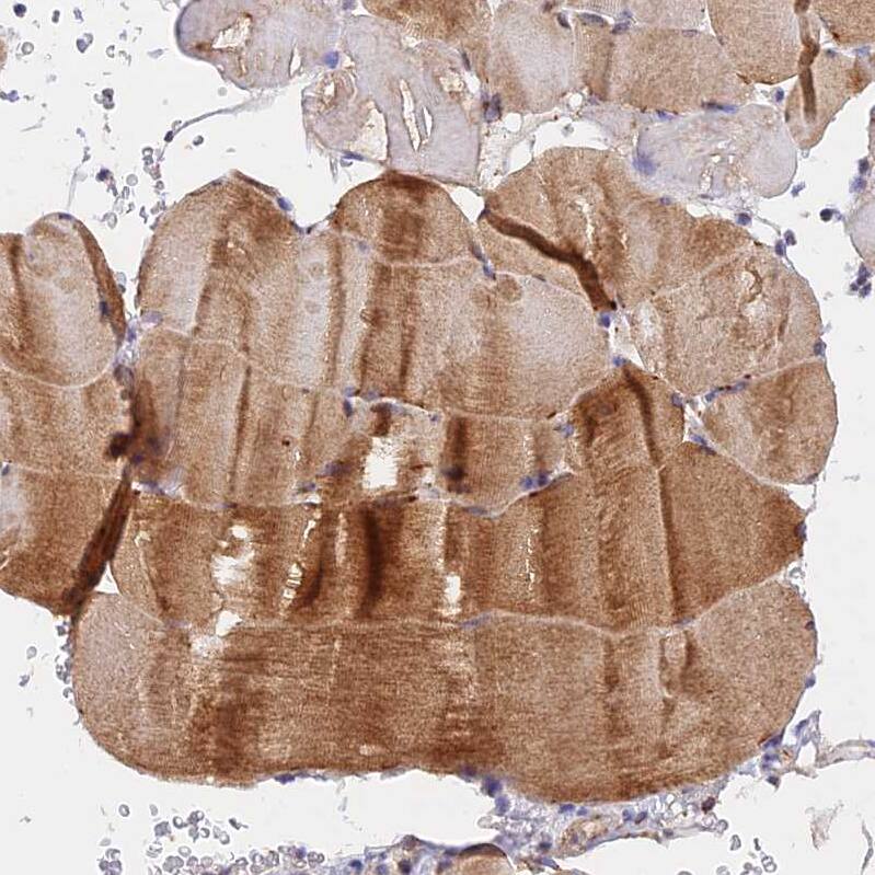 NDUFB6 Antibody - BSA Free Immunohistochemistry: NDUFB6 Antibody - BSA Free [NBP1-92172]