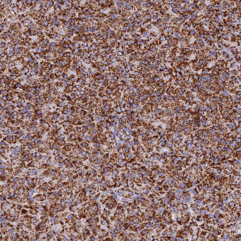 NDUFB6 Antibody - BSA Free Immunohistochemistry: NDUFB6 Antibody - BSA Free [NBP1-92172]