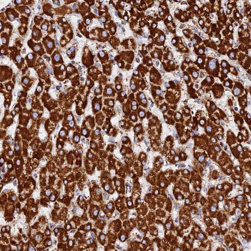NDUFB6 Antibody - BSA Free Immunohistochemistry: NDUFB6 Antibody - BSA Free [NBP1-92172]