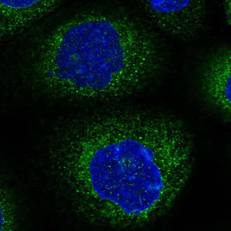 NEDL2 Antibody - BSA Free Immunocytochemistry/ Immunofluorescence: NEDL2 Antibody [NBP1-92174]