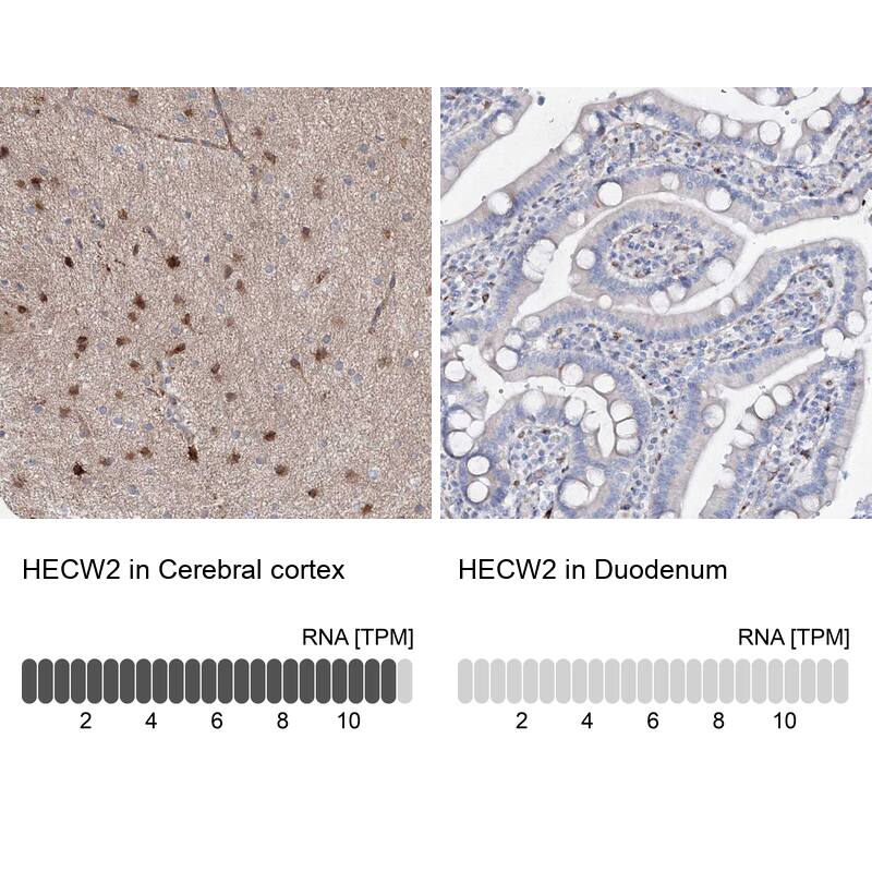 NEDL2 Antibody - BSA Free Immunohistochemistry: NEDL2 Antibody - BSA Free [NBP1-92174]