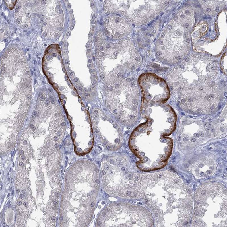 NELF Antibody - BSA Free Immunohistochemistry: NELF Antibody - BSA Free [NBP1-92175]