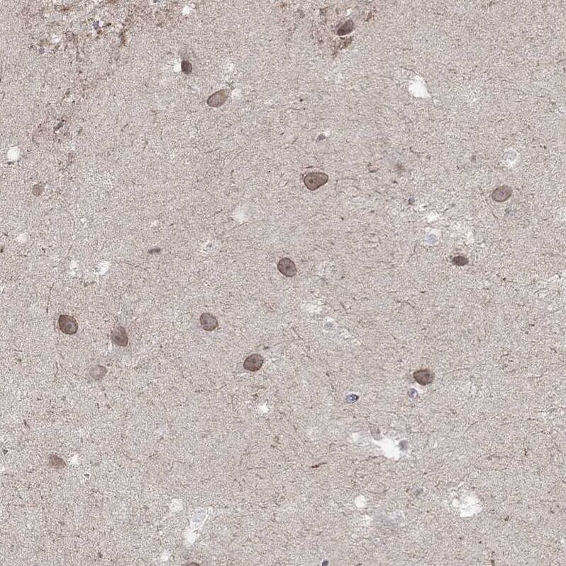NELF Antibody - BSA Free Immunohistochemistry: NELF Antibody - BSA Free [NBP1-92175]