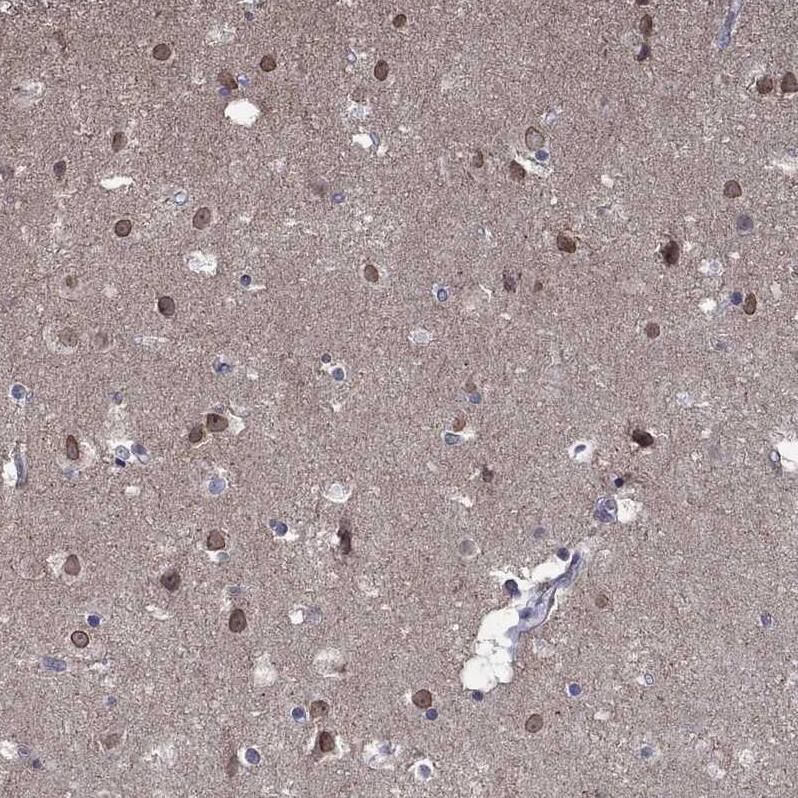 NELF Antibody - BSA Free Immunohistochemistry: NELF Antibody - BSA Free [NBP1-92175]
