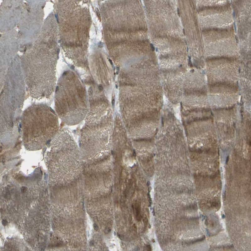 Nexilin Antibody - BSA Free Immunohistochemistry: Nexilin Antibody - BSA Free [NBP1-92179]