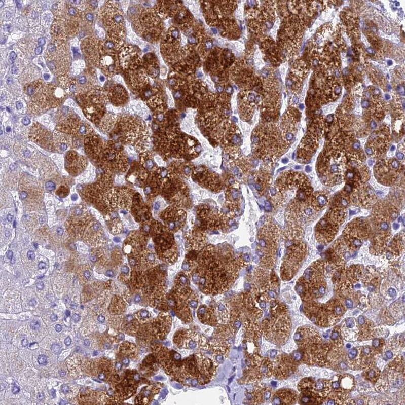 Ninjurin-1 Antibody - BSA Free Immunohistochemistry: Ninjurin-1 Antibody - BSA Free [NBP1-92181]