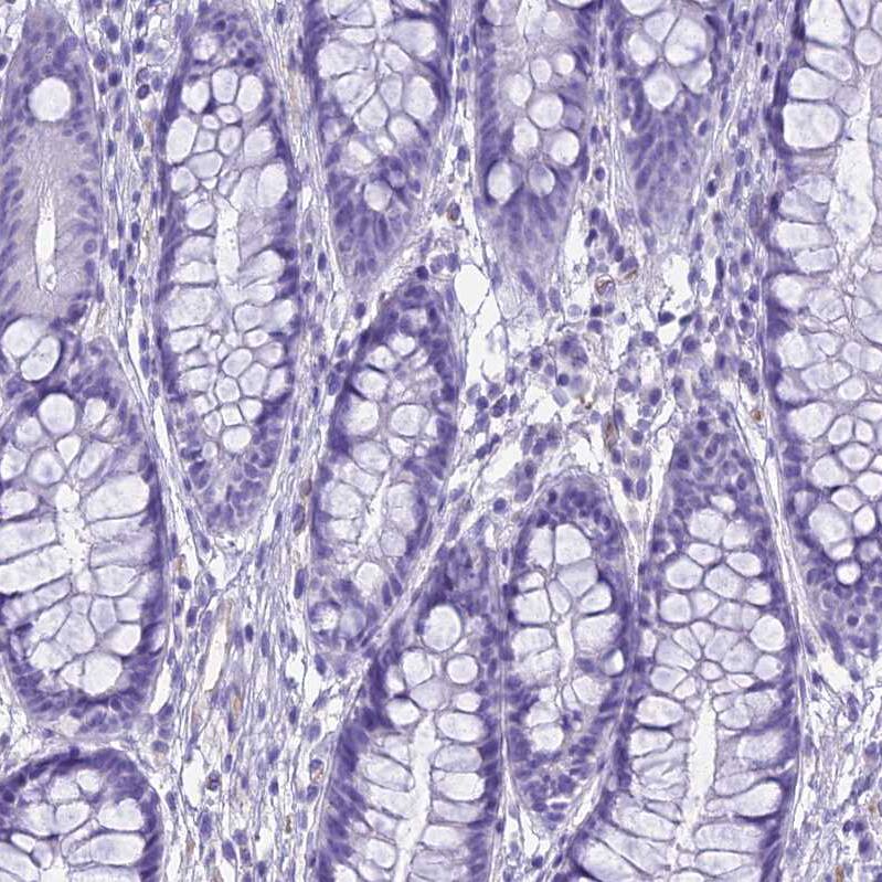 Ninjurin-1 Antibody - BSA Free Immunohistochemistry: Ninjurin-1 Antibody - BSA Free [NBP1-92181]