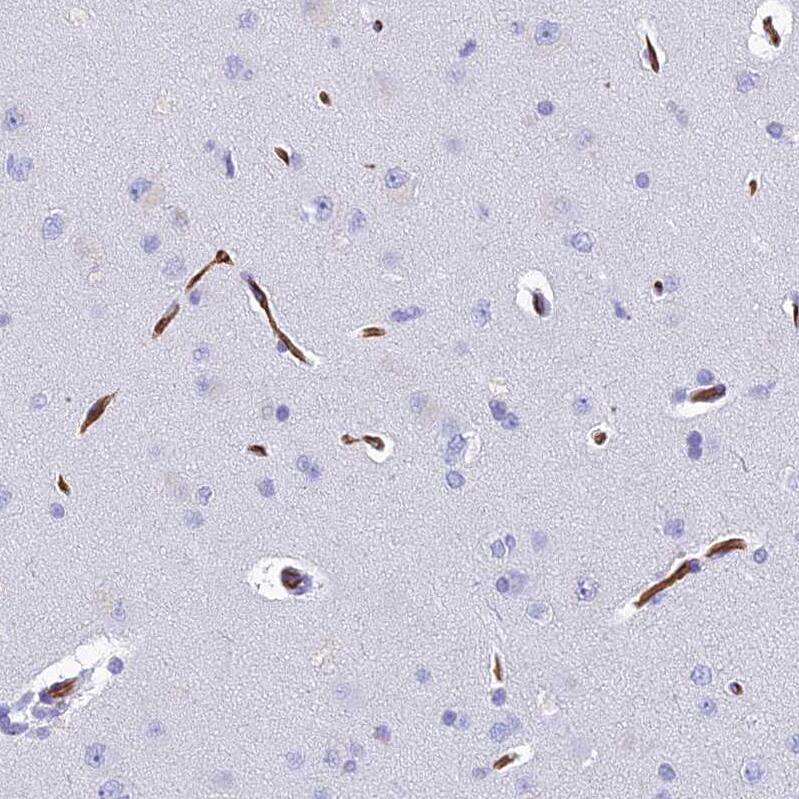 Ninjurin-1 Antibody - BSA Free Immunohistochemistry: Ninjurin-1 Antibody - BSA Free [NBP1-92181]