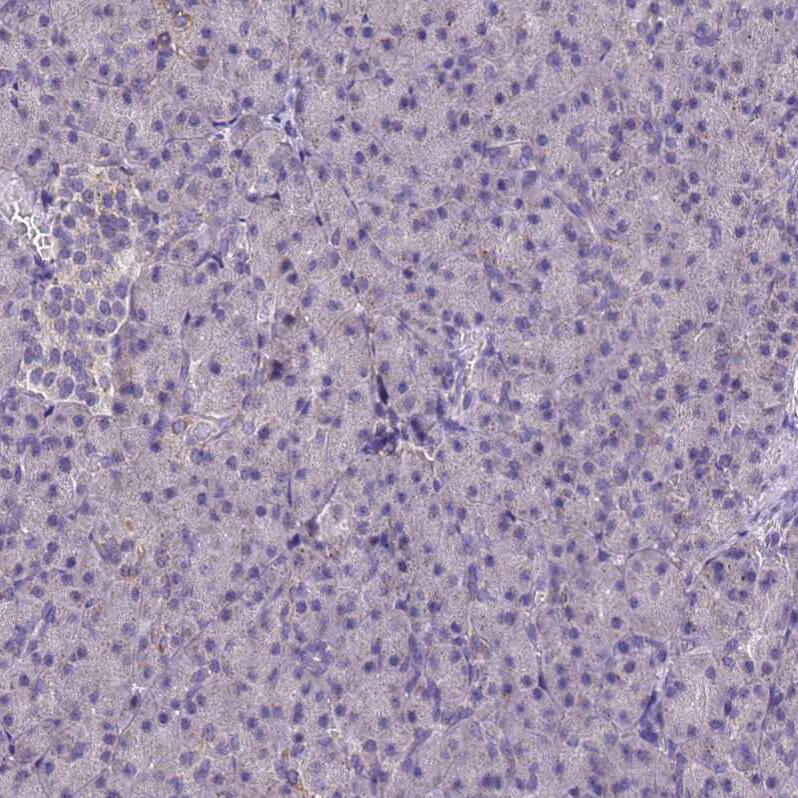 NLRP11 Antibody - BSA Free Immunohistochemistry: NLRP11 Antibody - BSA Free [NBP1-92186]