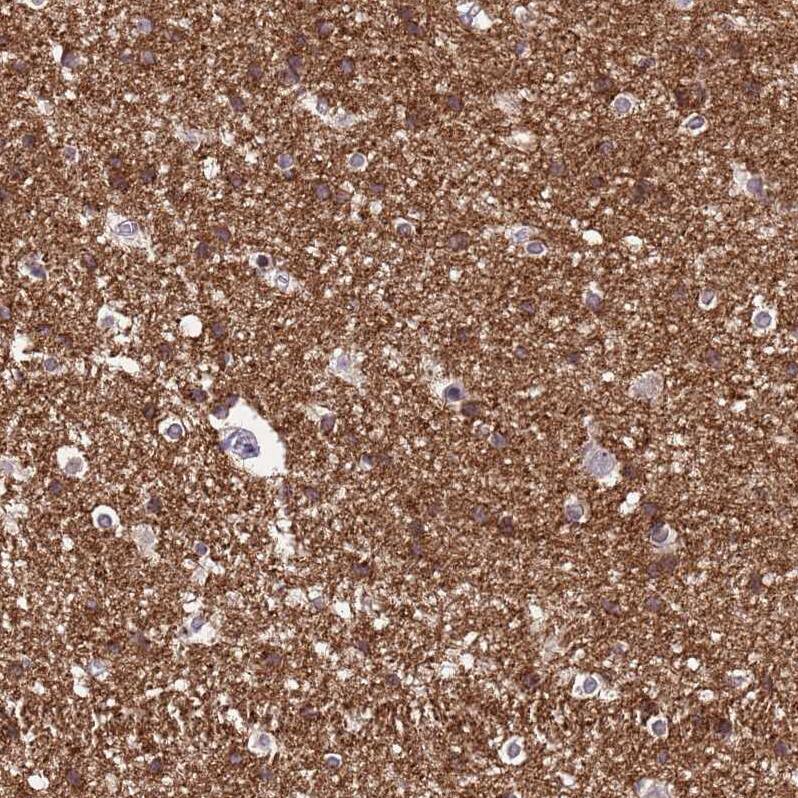 NLRP11 Antibody - BSA Free Immunohistochemistry: NLRP11 Antibody - BSA Free [NBP1-92186]