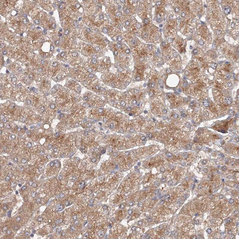 NMDARA1 Antibody - BSA Free Immunohistochemistry: NMDARA1 Antibody - BSA Free [NBP1-92187]