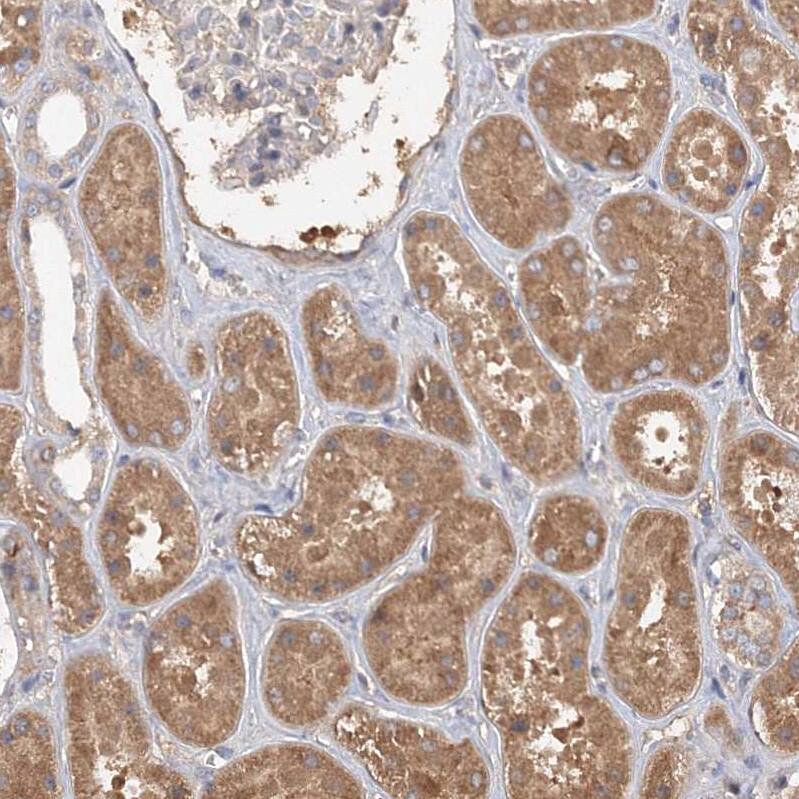 NMDARA1 Antibody - BSA Free Immunohistochemistry: NMDARA1 Antibody - BSA Free [NBP1-92187]