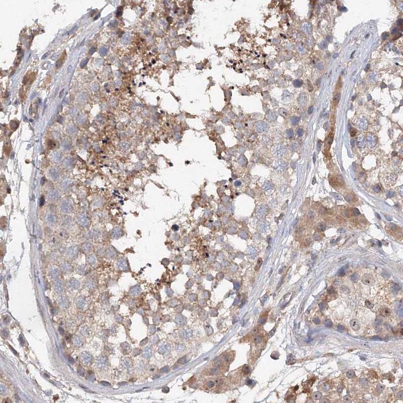 NMDARA1 Antibody - BSA Free Immunohistochemistry: NMDARA1 Antibody - BSA Free [NBP1-92187]