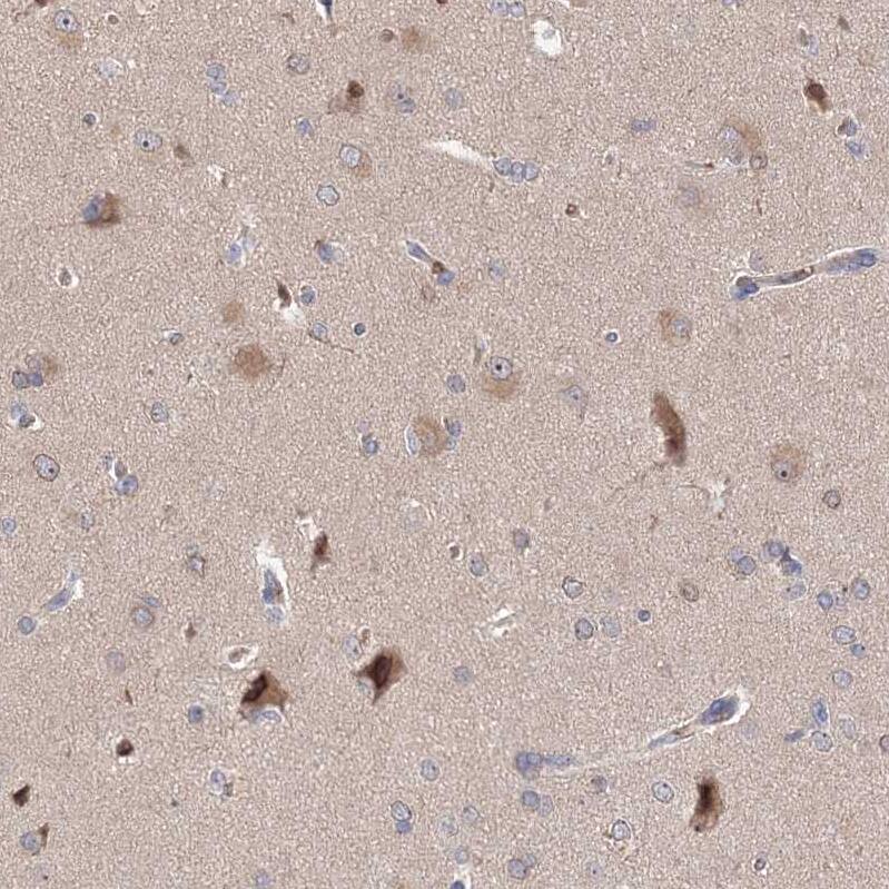 NMDARA1 Antibody - BSA Free Immunohistochemistry: NMDARA1 Antibody - BSA Free [NBP1-92187]