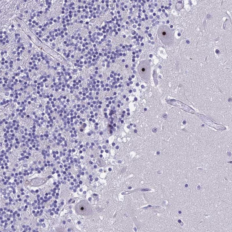 NOC2L Antibody - BSA Free Immunohistochemistry: NOC2L Antibody - BSA Free [NBP1-92190]