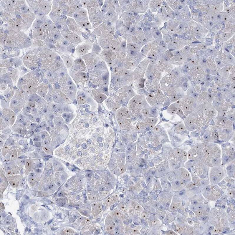 NOL1 Antibody - BSA Free Immunohistochemistry: NOL1 Antibody - BSA Free [NBP1-92192]