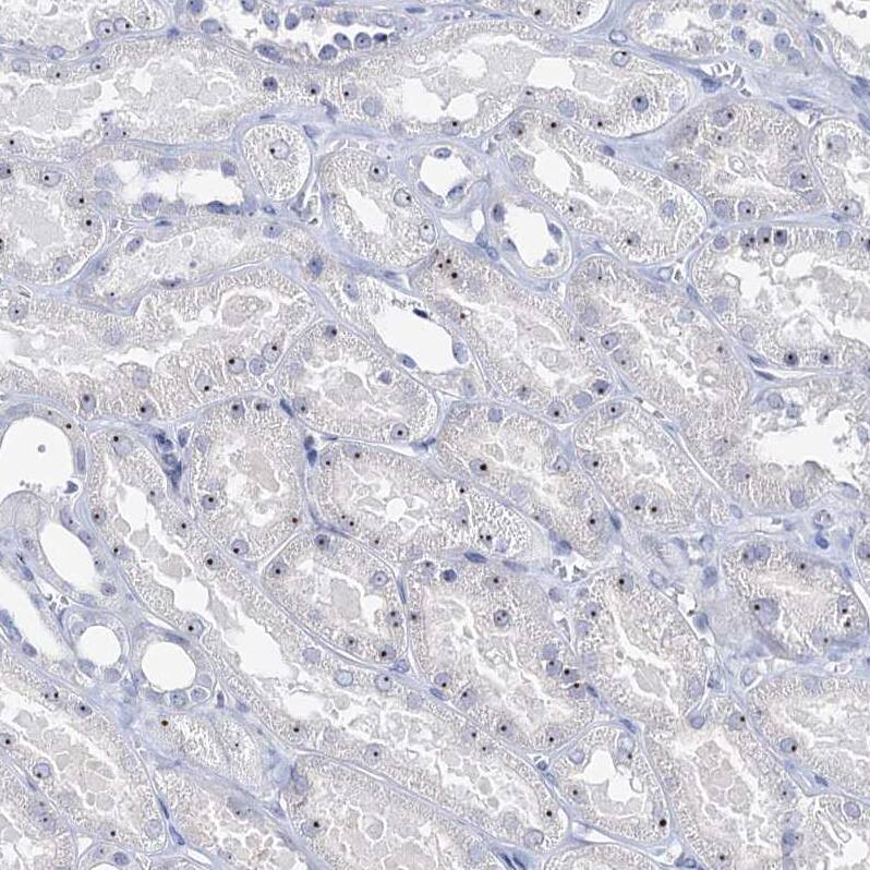 NOL1 Antibody - BSA Free Immunohistochemistry: NOL1 Antibody - BSA Free [NBP1-92192]