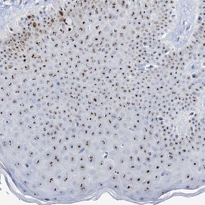 NOL1 Antibody - BSA Free Immunohistochemistry: NOL1 Antibody - BSA Free [NBP1-92192]
